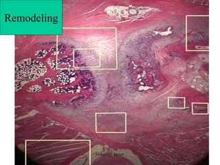 Remodeling
Remodeling
Histology bones 15
 