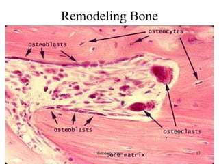 Remodeling Bone
Histology bones 17
 