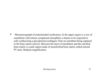 • Photomicrograph of endochondral ossification. In the upper region is a row of
osteoblasts with intense cytoplasmic basophilia, a feature to be expected in
cells synthesizing a glycoprotein (collagen). Note an osteoblast being captured
in the bone matrix (arrow). Between the layer of osteoblasts and the calcified
bone matrix is a pale region made of noncalcified bone matrix called osteoid.
PT stain. Medium magnification.
Histology bones 19
 