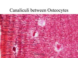 Canaliculi between Osteocytes
Histology bones 30
 