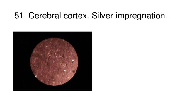 PSE-Cortex Übungsmaterialien