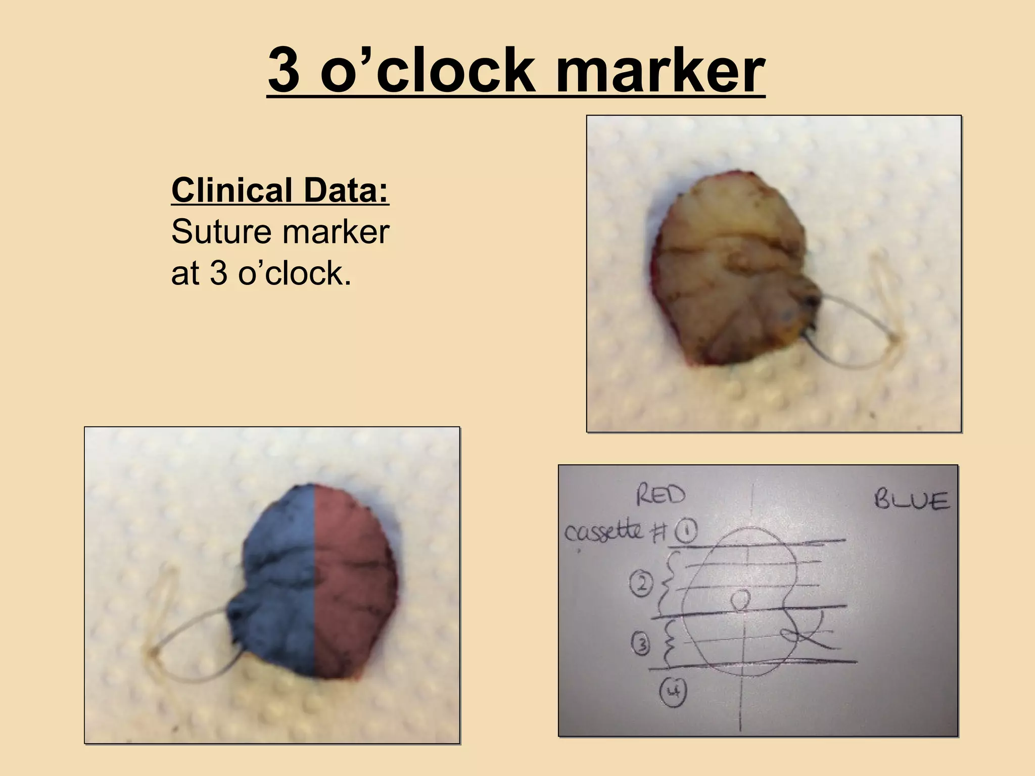 Specimen Reception Show Examples Histopathology In Practice - Sample Reception, Dissection, Processing ...