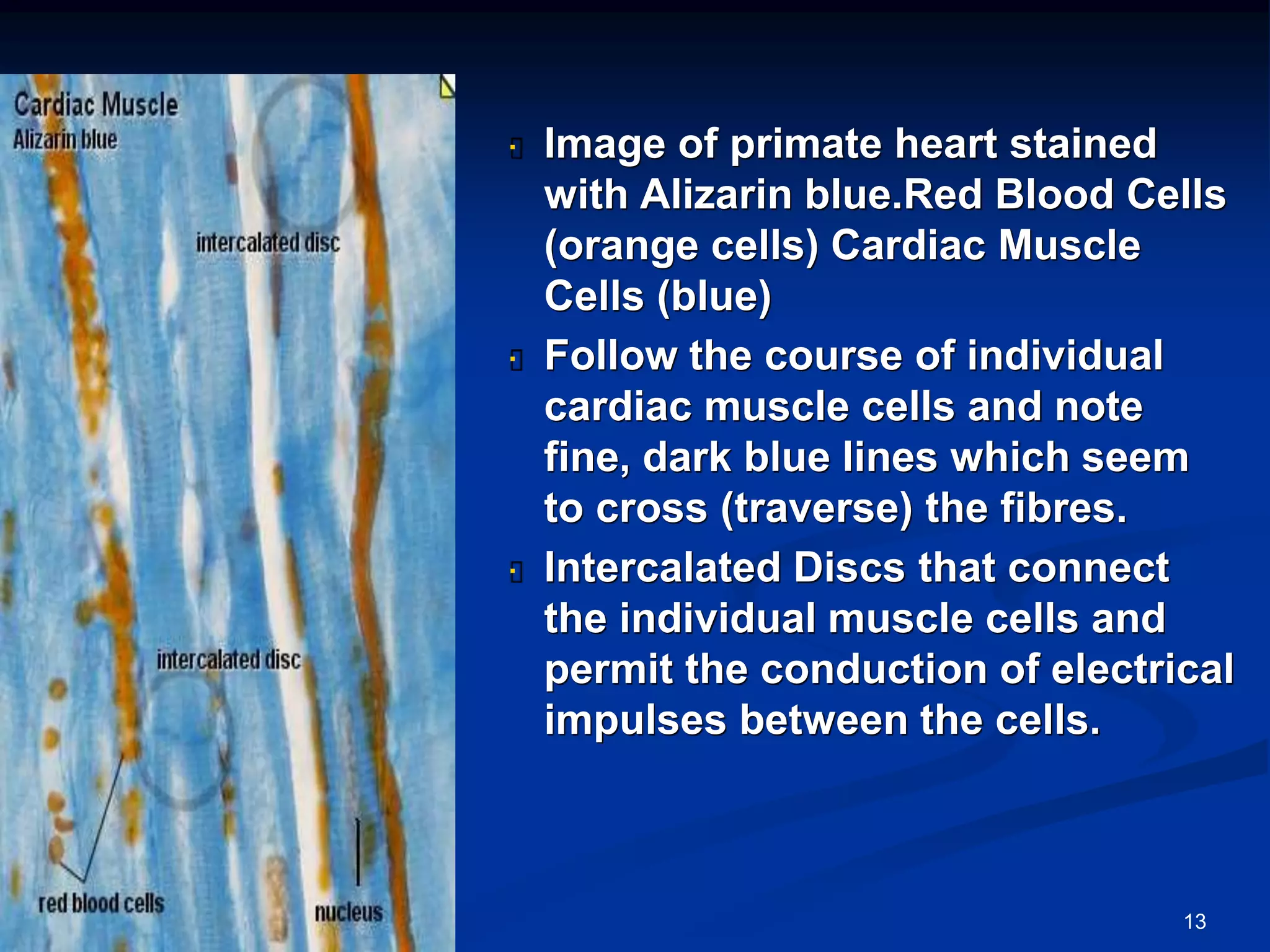 Histology of cardiac muscle | PPTX