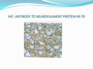 Nfib Cortex Histology of cerebral cortex | PPTX