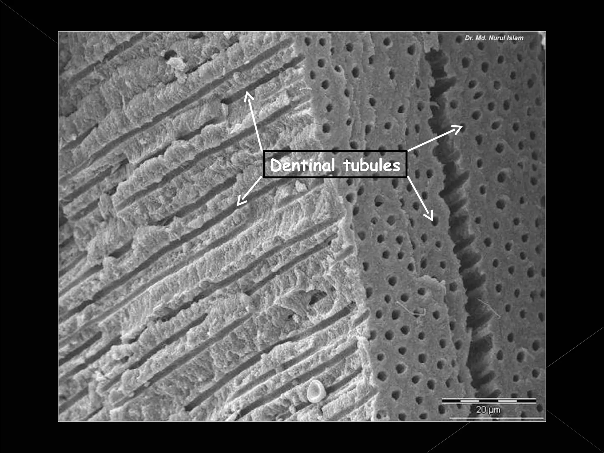 Histology of dentin | PPT