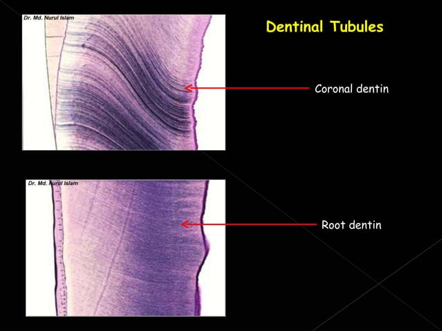 Histology of dentin | PPT | Dental Health | Diseases and Conditions