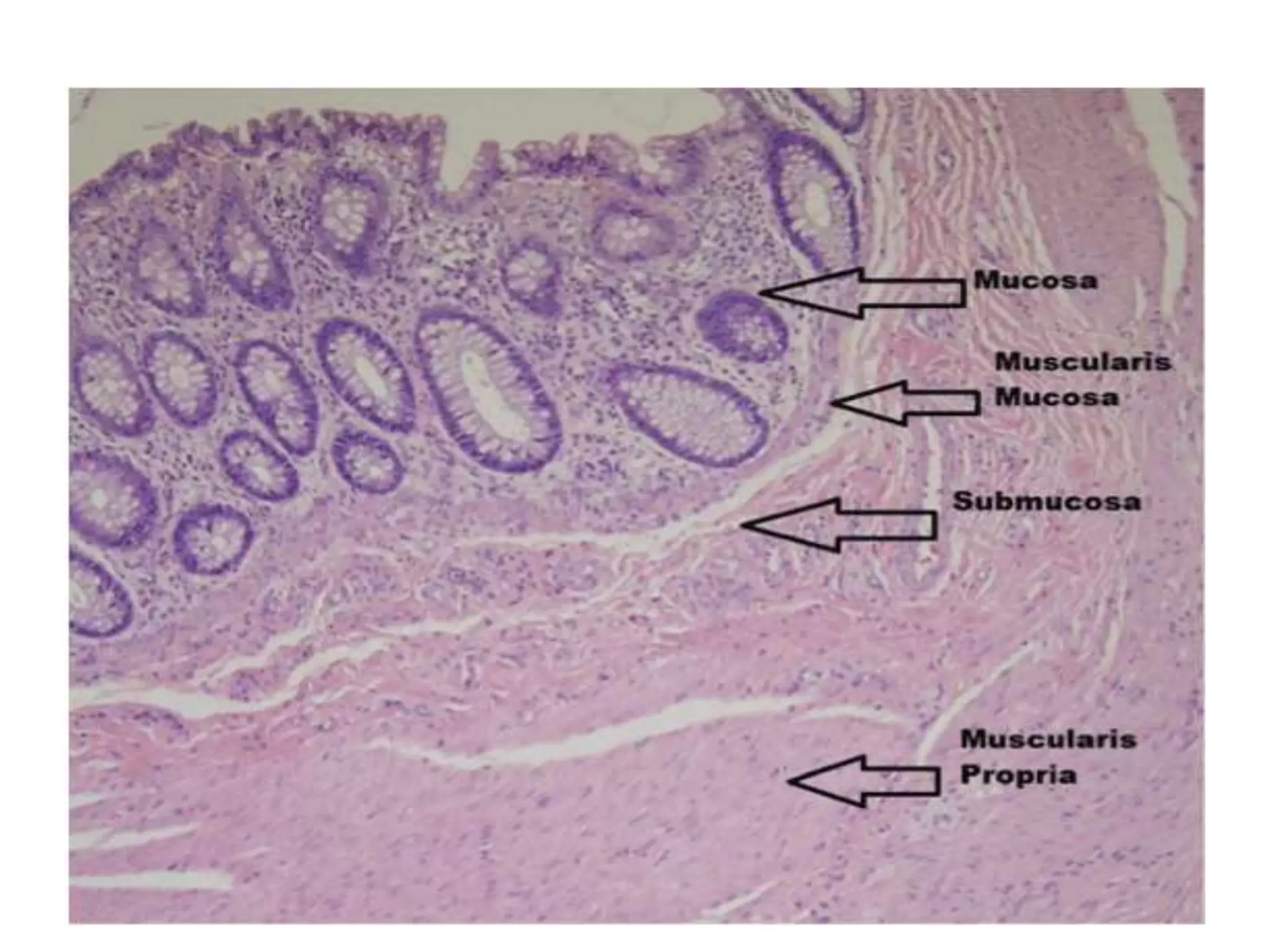 Histology of ibd | PPTX