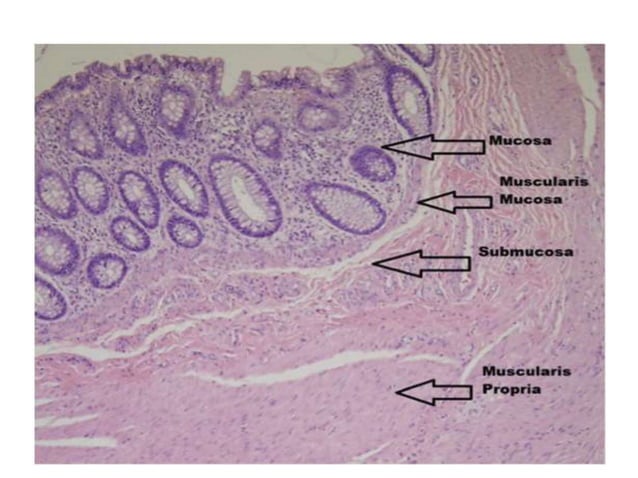 Histology of ibd | PPTX | Digestive Disorders | Diseases and Conditions