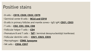 Positive stains
◦ B cells :- CD19, CD20, CD22, CD79
◦ Germinal center B cells :- BCL6 and CD10
◦ B cells in primary follicles and mantle zones:– IgD, IgM, CD21, CD23
◦ T cells :- CD2, CD3, CD4, CD8
◦ Follicular helper T cells :- CD4
◦ Premature B and T cells :- TdT ( terminal deoxynucleotidyl tranferase)
◦ Follicular dentritic cells :- CD21, CD23, CD35
◦ Macrophages:- CD68, lysozyme
◦ NK cells :- CD56, CD57
 