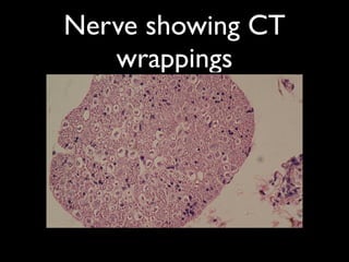 Neural Wraps Histology of nervous tissue | KEY
