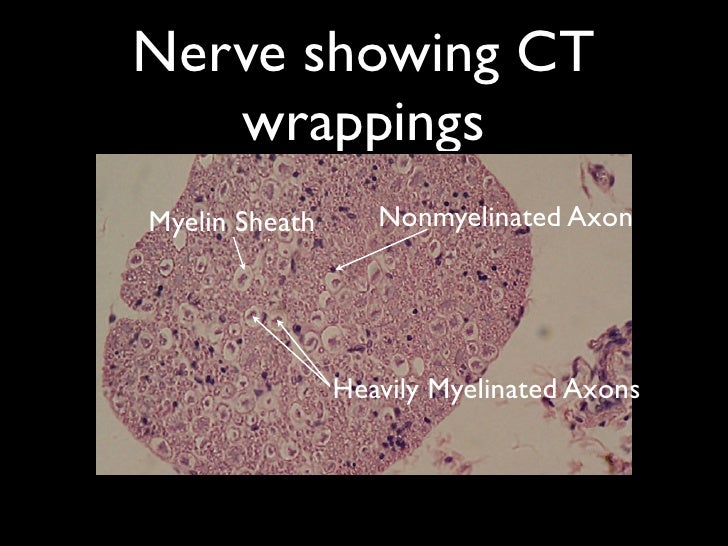 Myelinated Axon Slide
