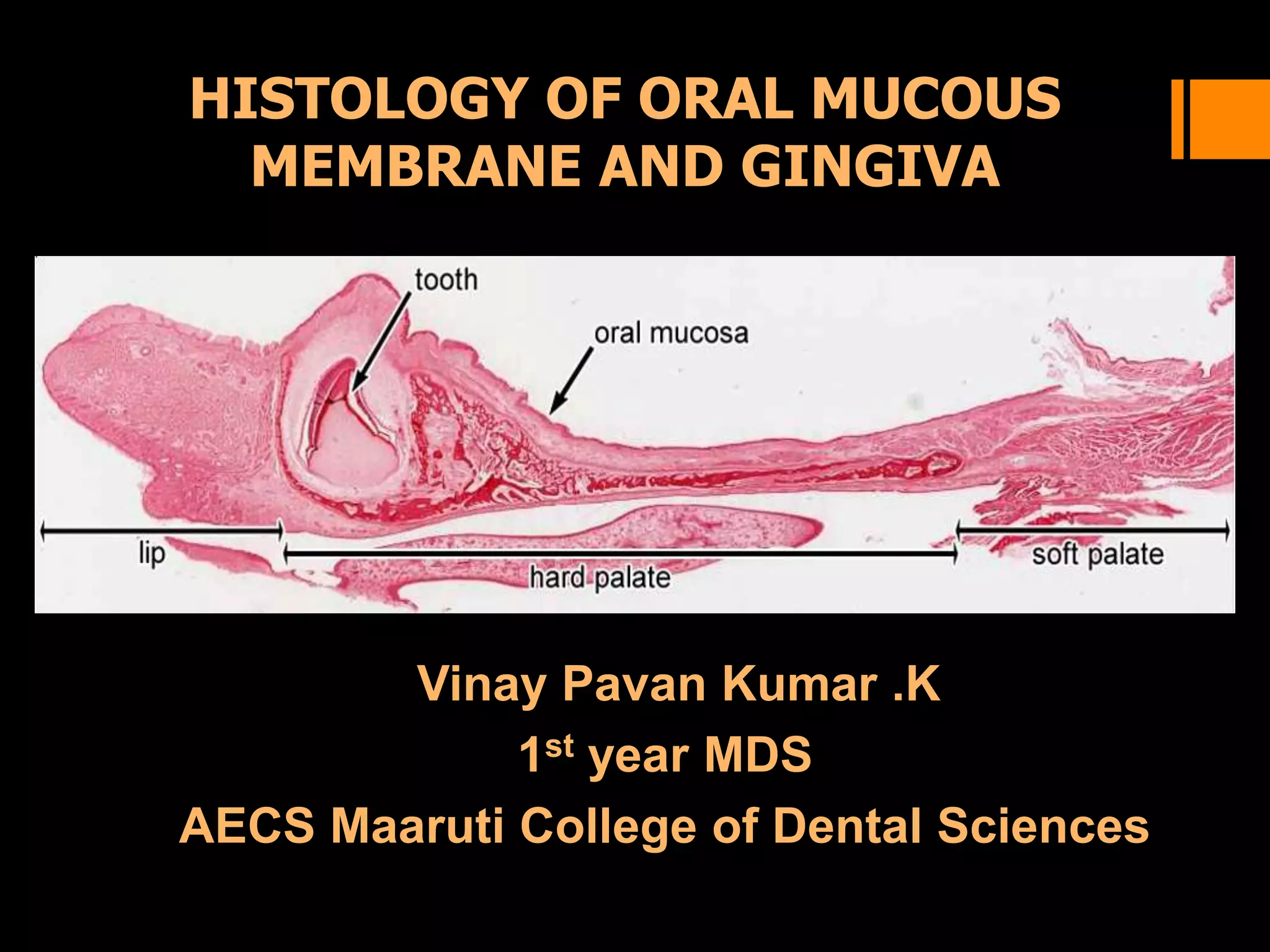 Histology of oral mucous membrane and gingiva | PPTX