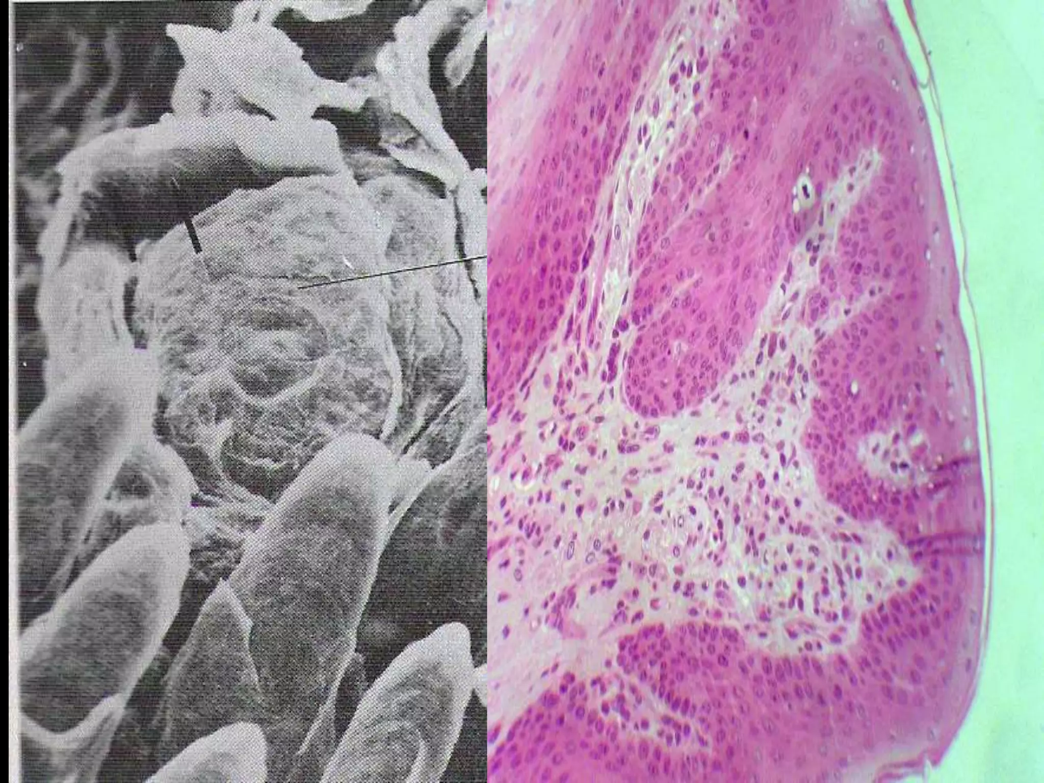 Histology of oral mucous membrane and gingiva | PPTX