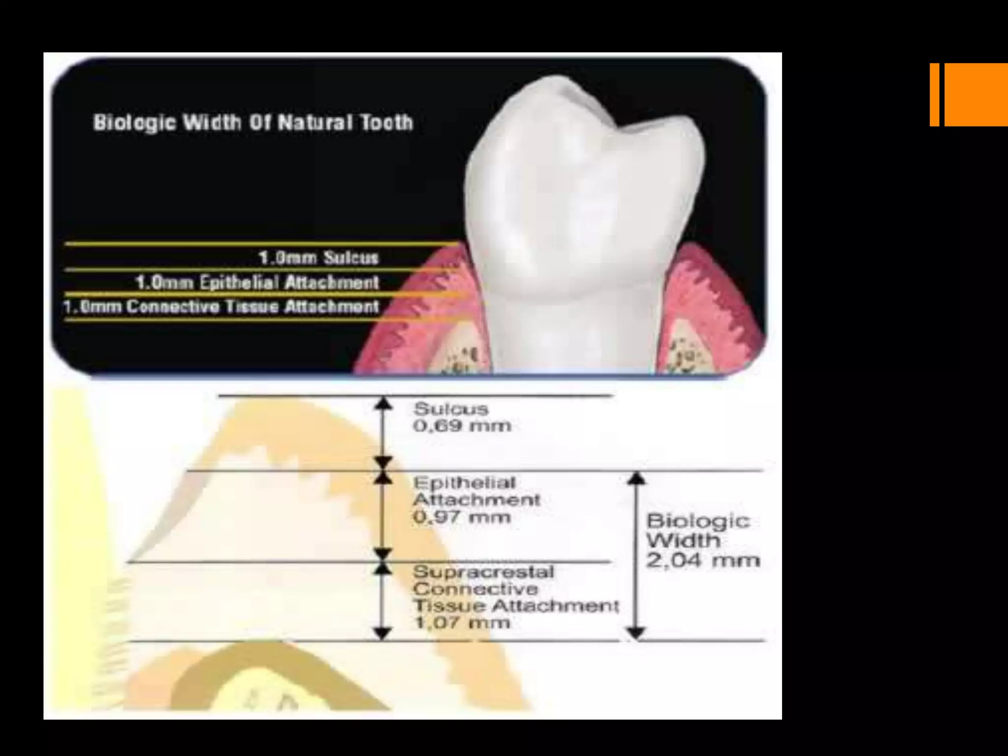 Histology of oral mucous membrane and gingiva | PPTX