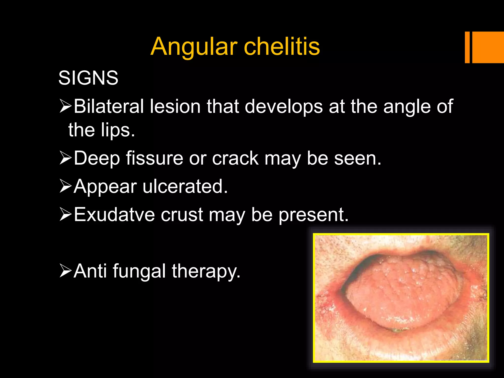 Histology of oral mucous membrane and gingiva | PPTX