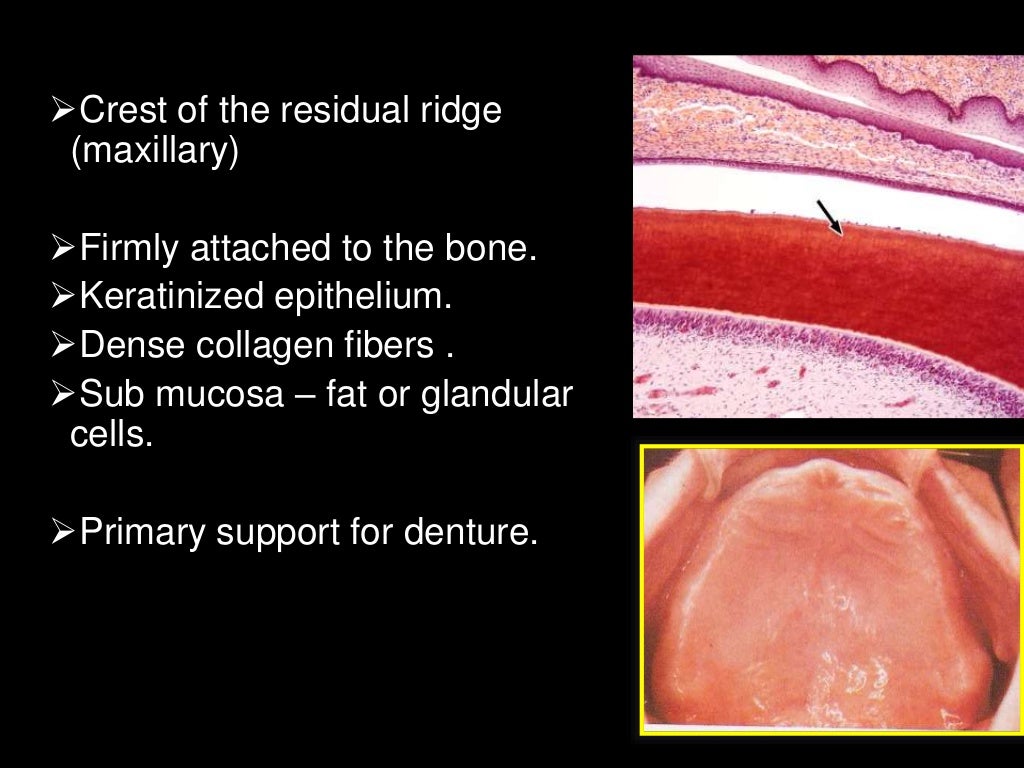 Histology of oral mucous membrane and gingiva