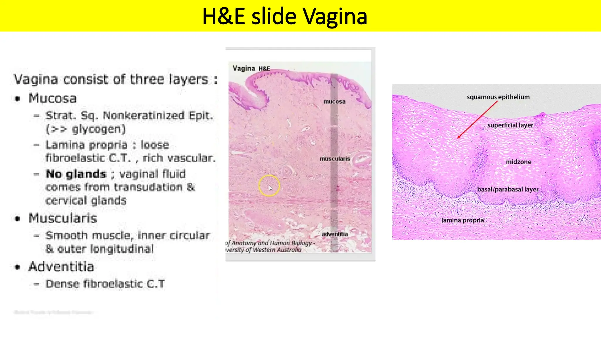 Histology of Ovaries, Uterine tubes, Uterus, Vagina..pptx