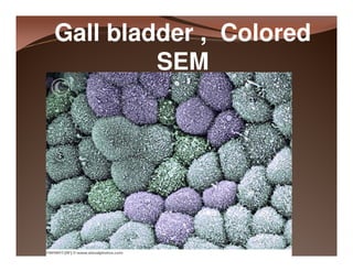 Histology of the liver and gall bladder [compatibility mode] | PDF
