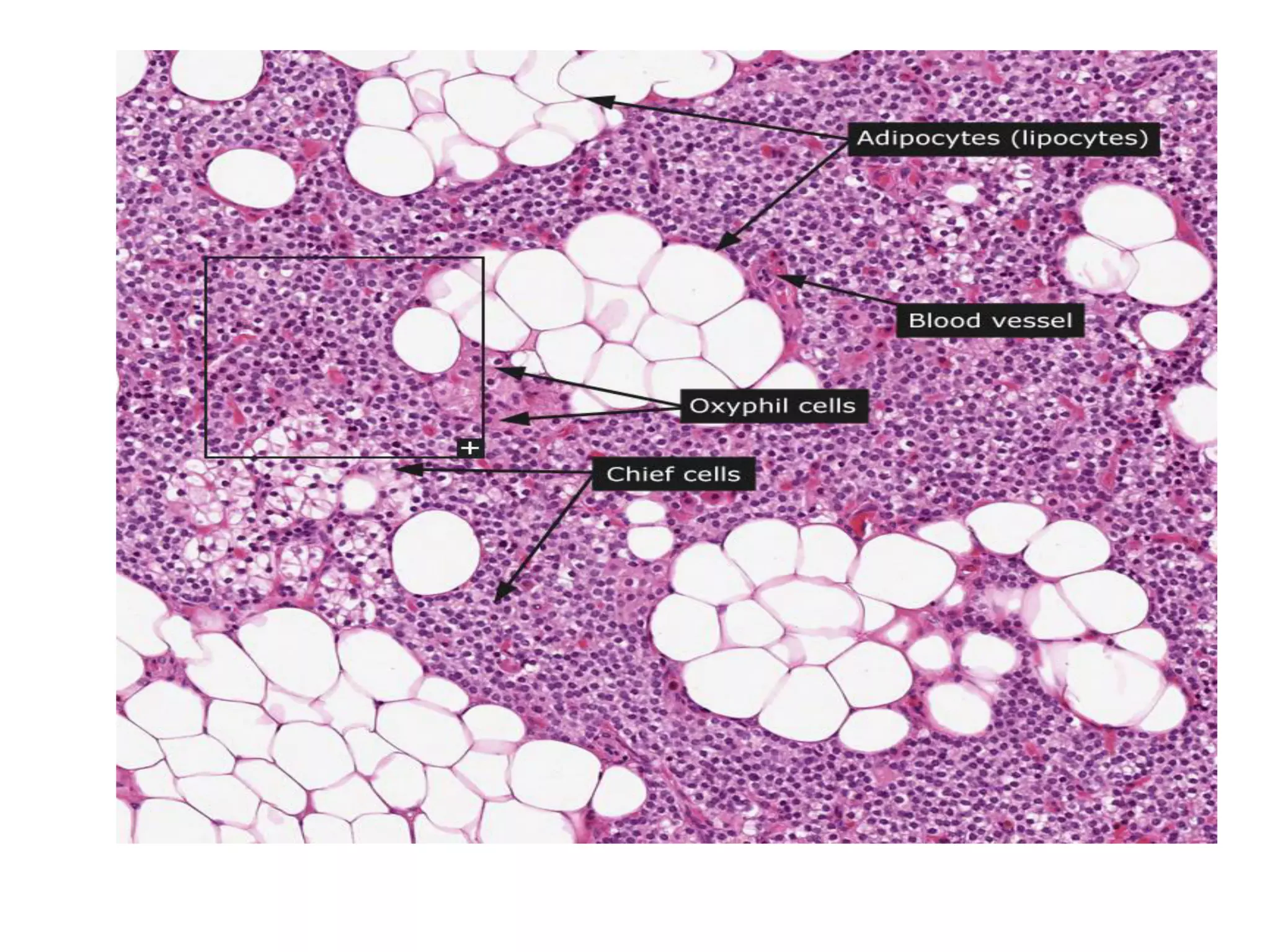 Histology Of Thyroid Gland And Pineal Gland PDF Thyroid Disorders histology-of-thyroid-gland-and-pineal-gland-pdf-thyroid-disorders