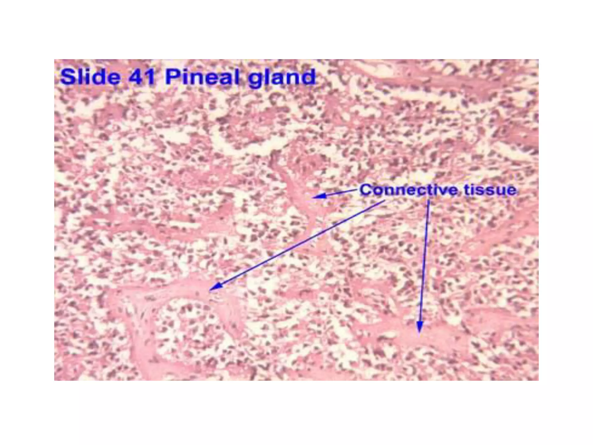 Histology of thyroid gland and pineal gland | PDF | Thyroid Disorders ...
