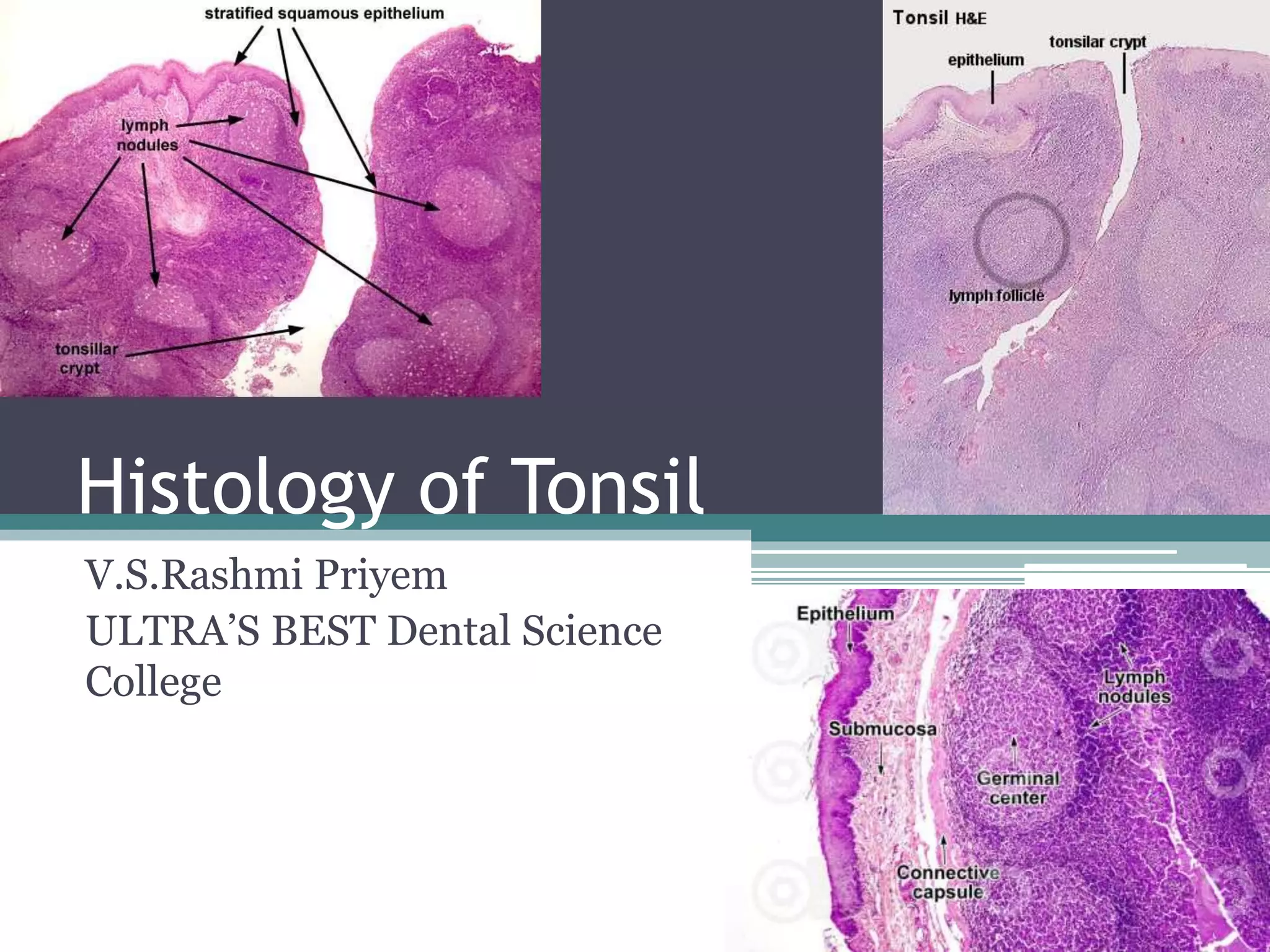 Histology of Tonsil
V.S.Rashmi Priyem
ULTRA’S BEST Dental Science
College
