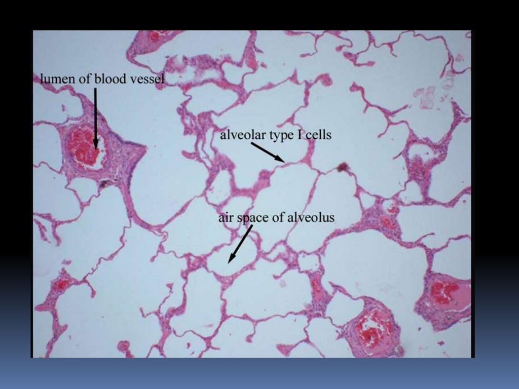 Histology of trachea and lung
