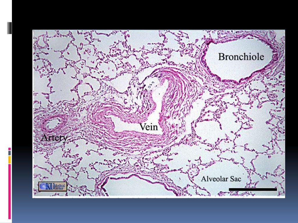 Histology of trachea and lung