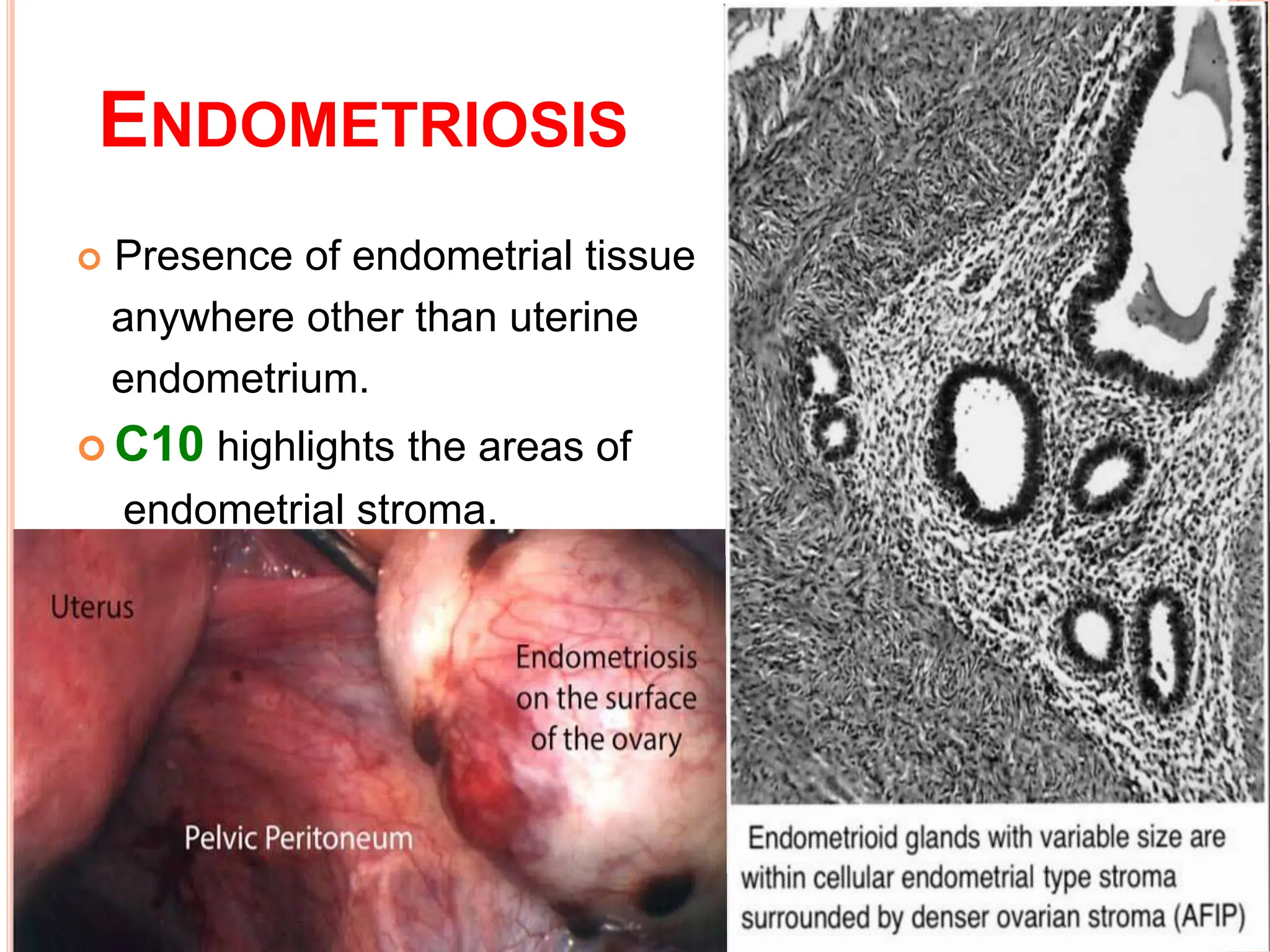 Histology of uterine endometrium.pptxXXX | PPTX