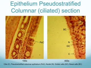 Pscc Epithelim Histology Portfolio | PPTX