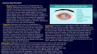 HUMAN EYE(STRUCTURE AND FUNCTIONS)pptx | PPTX