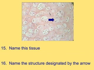 15. Name this tissue


16. Name the structure designated by the arrow
 