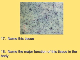 17. Name this tissue


18. Name the major function of this tissue in the
body
 