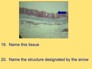 19. Name this tissue


20. Name the structure designated by the arrow
 