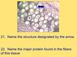 21. Name the structure designated by the arrow


22. Name the major protein found in the fibers
of this tissue
 