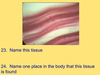 23. Name this tissue


24. Name one place in the body that this tissue
is found
 
