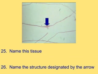 25. Name this tissue


26. Name the structure designated by the arrow
 