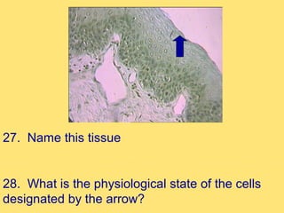 27. Name this tissue


28. What is the physiological state of the cells
designated by the arrow?
 