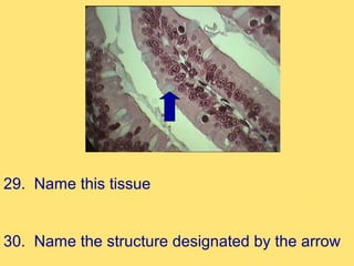 29. Name this tissue


30. Name the structure designated by the arrow
 