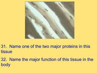 31. Name one of the two major proteins in this
tissue
32. Name the major function of this tissue in the
body
 