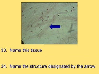 33. Name this tissue


34. Name the structure designated by the arrow
 