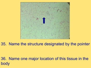 35. Name the structure designated by the pointer


36. Name one major location of this tissue in the
body
 