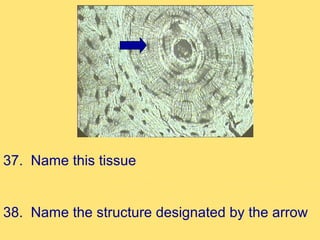 37. Name this tissue


38. Name the structure designated by the arrow
 