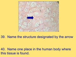 39. Name the structure designated by the arrow


40. Name one place in the human body where
this tissue is found.
 