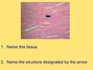1. Name this tissue


2. Name the structure designated by the arrow
 