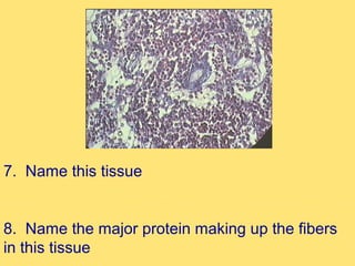 7. Name this tissue


8. Name the major protein making up the fibers
in this tissue
 