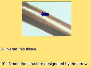 9. Name this tissue


10. Name the structure designated by the arrow
 