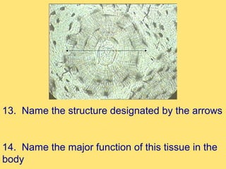 13. Name the structure designated by the arrows


14. Name the major function of this tissue in the
body
 