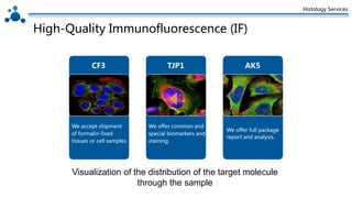Histology Services
High-Quality Immunofluorescence (IF)
Visualization of the distribution of the target molecule
through the sample
We accept shipment
of formalin-fixed
tissues or cell samples.
We offer common and
special biomarkers and
staining.
We offer full package
report and analysis.
CF3 TJP1 AK5
 
