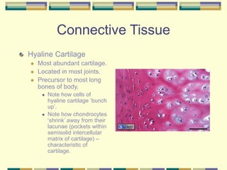 Connective Tissue
Hyaline Cartilage
 Most abundant cartilage.
 Located in most joints.
 Precursor to most long
bones of body.
 Note how cells of
hyaline cartilage ‘bunch
up’.
 Note how chondrocytes
‘shrink’ away from their
lacunae (pockets within
semisolid intercellular
matrix of cartilage) –
characteristic of
cartilage.
 