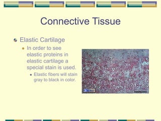 Connective Tissue
Elastic Cartilage
 In order to see
elastic proteins in
elastic cartilage a
special stain is used.
 Elastic fibers will stain
gray to black in color.
 